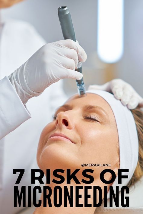 7 Things to Know Before Trying Microneedling Micro Needling Benefits, Rf Microneedling Before And After, Micro Needling Before And After, Microneedling Before And After, At Home Microneedling, Microneedling Benefits, Benefits Of Microneedling, After Microneedling, Facial Procedure