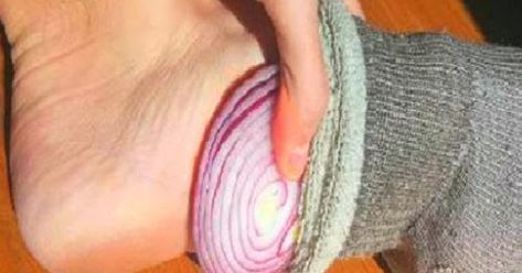 Onion In Sock, Onion In Your Sock, How To Stop Coughing, Salad Diet, Cough Remedies, Cold Remedies, Detox Your Body, Natural Healing, Onions