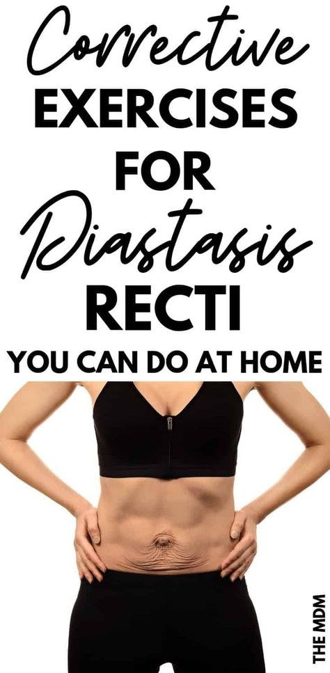 Ab Separation Exercises for Diastasis Recti You Can Do At Home #diastasisrecti #abseparation #postpartumexercise Gym Workouts For Diastasis Recti, Exercises For Ab Separation, Abdominal Separation Diastasis Recti, Exercises For Abdominal Separation, Ab Exercises After C Section, How To Fix Diastasis Recti Years Later, Heal Diastasis Recti Exercises, Severe Diastasis Recti, Diastasis Recti Program