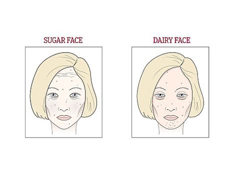 Do You have Dairy Face? | Fashion, Trends, Beauty Tips & Celebrity Style Magazine | ELLE UK Droopy Eyelids, Celebrity Beauty Secrets, Natural Beauty Treatments, Korean Beauty Secrets, Face Mapping, Dark Circles Under Eyes, Hair Rinse, Healthy Glowing Skin, Beauty Advice