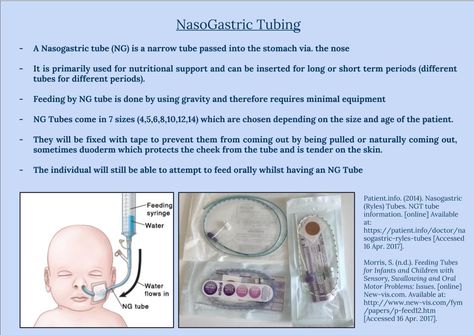 Facts about NasoGastric Tubing  Download @ https://docs.google.com/presentation/d/1_kwQiRTxU1wt7xBSggr94k81o_0f4wCJpD5ZLjCAKeM/edit?usp=sharing Nasogastric Tube Nursing, Nasogastric Tube, Nursing Skills, Speaking Tips, Med Surg, Nursing Career, Nursing Study, Medical School, School Stuff