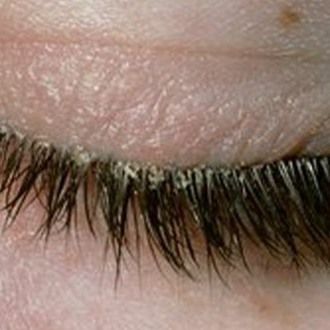 Did you know that regular lash cleansing is vital for eye health? It helps remove dirt, oil, and bacteria, reducing the risk of infections and irritation. Clean lashes are especially important for those with eyelash extensions. They prevent Demodex blepharitis and other complications and avoid overpopulation of Demodex mite growth on the lash line. Swipe right to see. Our Eyelove cleanser, formulated with gentle, natural ingredients, ensures your lashes stay healthy and your eyes comfort... Eye Lash Care, Clean Lashes, Demodex Mites, Lash Care, Healthy Eyes, Swipe Right, Blowout Sale, Eye Health, Stay Healthy