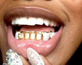 Grillz Bottom Row Grillz, Open Face Grillz For Women, Black Women Grillz, Open Face Grillz, Gold Teeth Grillz, Blonde Hair Types, Pretty Teeth, Grillz Teeth, Diamond Grillz