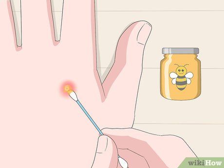 How to Treat Bee Sting Swelling: 10 Steps (with Pictures) How To Treat A Bee Sting, Bee Stings Relief Swelling, Bee Sting Remedy, Bee Sting Swelling, Bee Sting Relief, Treating Bee Stings, Hornet Sting, Yellow Jacket Bee, Remedies For Bee Stings