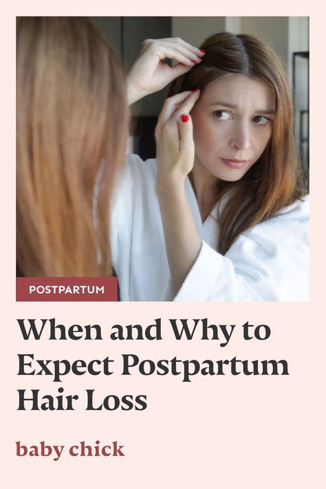 If you're losing hair after the birth of your child, don't worry! Postpartum hair loss is normal. Here's what you need to know. #postpartumhairloss #postpartum #postpartumperiod What Is Postpartum, Postpartum Hair, Losing Hair, Improve Hair Growth, Motherhood Inspiration, Going Bald, Hair Shedding, Baby Chick, Volumizing Shampoo