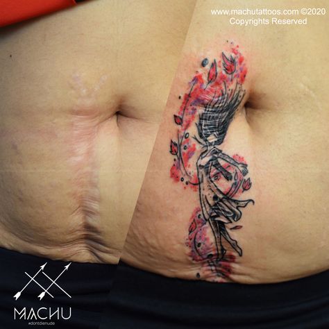 Stomach scar coverup tattoo by suresh machu from machu tattoos #tattoo #coveruptattoo #scarcoverup #scarymakeup #art #girltattoo #watercolortattoo #funny Scar Coverup Tattoo, Appendix Surgery, Tattoos Cool, Tattoo Over Scar, Scar Cover Up, Coverup Tattoo, Tattoo Cover Up, Scary Makeup, Tattoo Cover-up