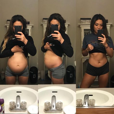 Michelle's photos of her bloated stomach went viral as they showed how severe it can be. Blast Belly Fat, Bloated Stomach, Bloated Belly, Low Fodmap Diet, Fodmap Diet, Acid Reflux, Lose 20 Pounds, Burn Belly Fat, Eye Bags