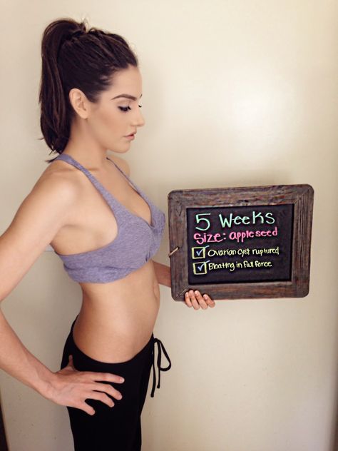 Zack&Sydney: Ruptured Cyst at 5 Weeks & 6-7 Week Pregnancy Update 5 Weeks Pregnant Belly, 5 Weeks Pregnant Ultrasound, Five Weeks Pregnant, 8 Weeks Pregnant, 7 Weeks Pregnant, 9 Weeks Pregnant, 6 Weeks Pregnant, 10 Weeks Pregnant, 5 Weeks Pregnant