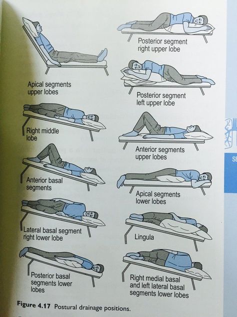 Postural drainage Healthy Breakfast Pictures, Postural Drainage, Pta Board, Physical Therapy School, Pt School, Physical Therapy Student, Remedial Massage, Nursing Student Tips, Nursing School Survival