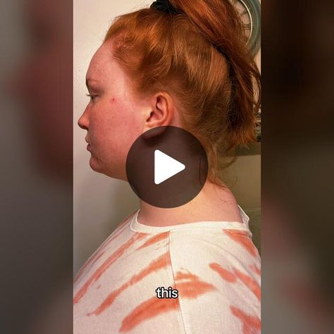 How to fix tech neck #neckhump #neckhumpfix #neckhumpexercises #neckhu... | neck lump exercise | TikTok Hicks On Neck, Exercise Tiktok, Neck Hump, Tech Neck, Hair Up Styles, Up Styles, Up Hairstyles, Fix It, Make Your Day