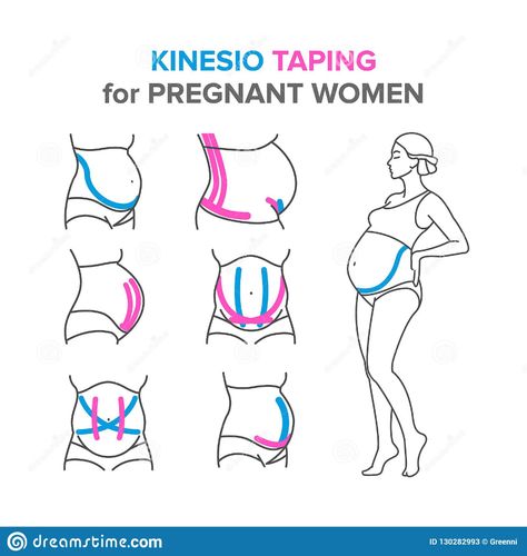 K Tape, Kinesio Taping, Belly Support, Baby Life Hacks, Kinesiology Taping, Pregnancy Health, Foto Baby, Future Mom, Pregnancy Care