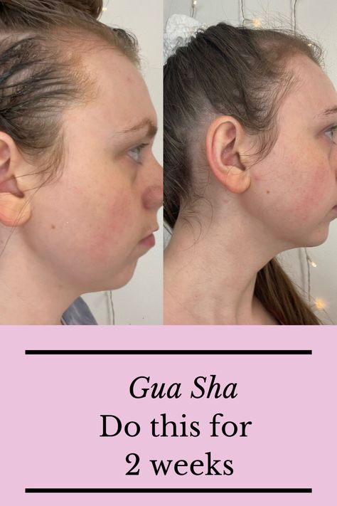 Gau Sha, Brow Wrinkles, Youtube Creator, Tear Trough, Neck Firming, Gua Sha Facial, Face Exercises, Makeup Hairstyle, How To Clean Metal