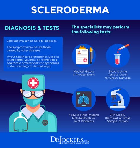 Scleroderma Symptoms, Scleroderma Awareness, Autoimmune Disease Symptoms, Nursing 101, Autoimmune Diet, Auto Immune, Applied Nutrition, Connective Tissue, Lung Disease