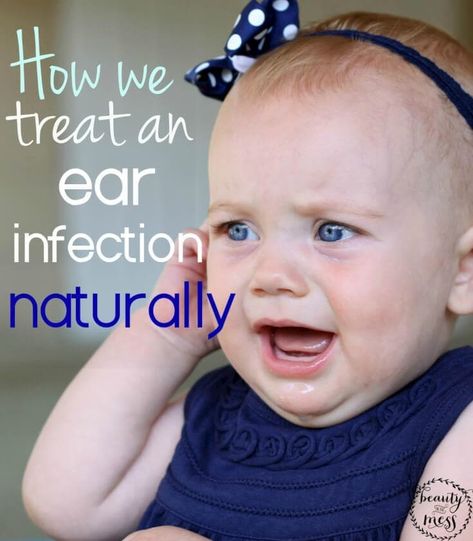 Ear Infection How to Heal an Ear Infection Naturally Earache Remedies, Mom Dr, Ear Infections, Holistic Remedies, Healthy Babies, Baby Health, Natural Home Remedies, Kids Health, Diy Natural Products