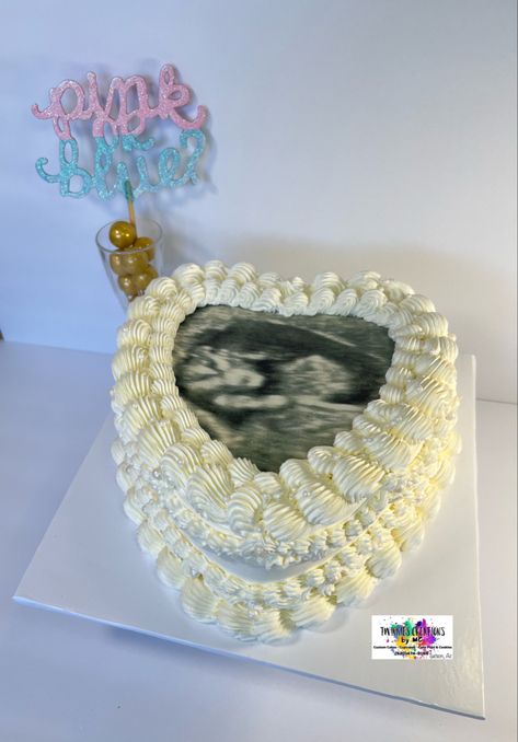 Gender reveal cake Heart Shaped Cake, Ultrasound Pictures, Shaped Cake, Heart Shaped Cakes, Gender Reveal Cake, Mom Era, Heart Cake, Cake Cover, Edible Images