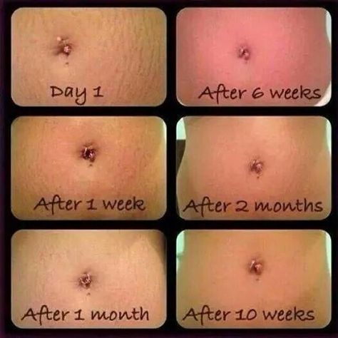 Wanna get rid of loose post baby skin, or a c-section scar...let's talk!!! Combination Skin Makeup, Amp Md Roller, Rodan Fields Skin Care, Rodan And Fields Business, Rodan And Fields Consultant, Stretch Mark Removal, Stretch Mark Cream, After Pictures, Love Your Skin