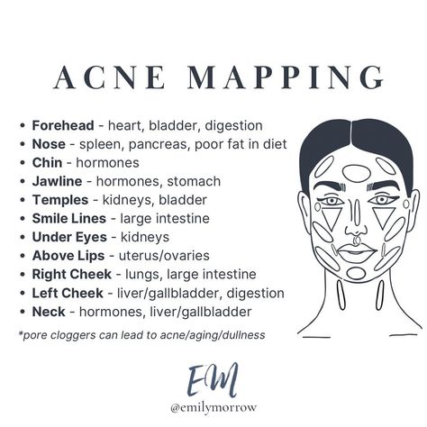 Acne face mapping is a technique that involves examining the location of acne on the face to determine potential underlying health issues.… | Instagram Acne Placement Meaning, Acne Face Mapping, Acne Face Map, Face Map, Hormone Nutrition, Causes Of Acne, Face Mapping Acne, Blood Work, Forehead Acne