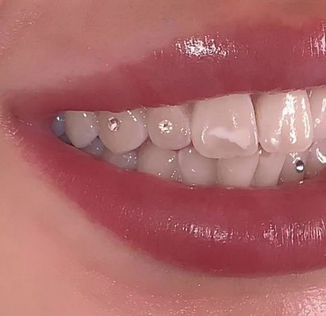 Aesthetic Tooth Gems, Diamond Tooth Gem Aesthetic, Teeth Jewelry Aesthetic, Diamond Teeth Jewelry, Strass Teeth, Toothgems Ideas, Teeth Gems Aesthetic, Teeth Jewelry Tooth Gems, Teeth Gems Ideas