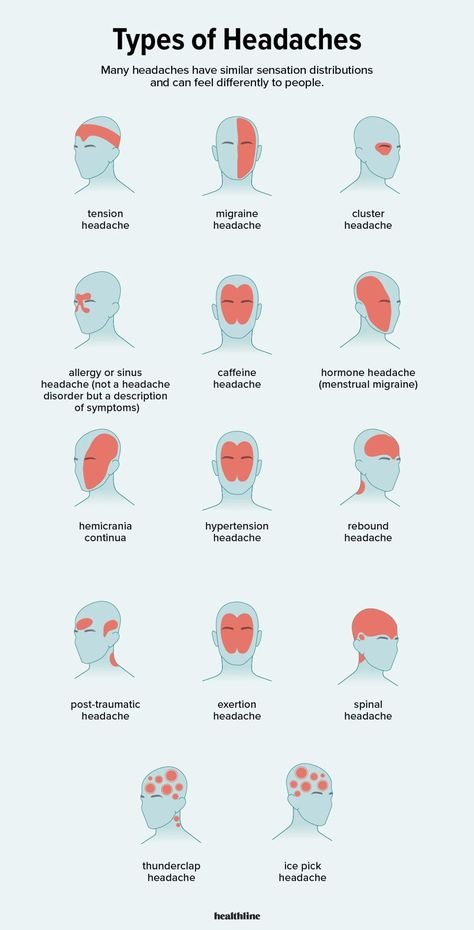 Types of Headaches: Symptoms, Causes, Treatments, and More Headache Types, Migraine Headaches, Medical Knowledge, Alam Semula Jadi, Health Info, Health And Beauty Tips, Health Facts, Home Health, Useful Life Hacks