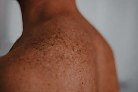 Freckles Face Claim Male, Tan Skin Freckles Aesthetic, Freckles On Tan Skin, Ginger Aesthetic Male, Tan Skin Aesthetic Male, Tan Man Aesthetic, Scars On Dark Skin Reference, Tanned Skin Aesthetic, Baldurs Gate Aesthetic