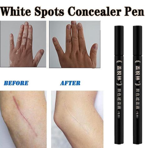 Buy Use White Spots Concealer Vitiligo Scars Cover Pen Camouflage Makeup Tattoo Concealer Liquid at affordable prices — free shipping, real reviews with photos — Joom Tattoo Concealer, Camouflage Makeup, Concealer Pen, Minimalist Makeup, Makeup Tattoo, Makeup Tattoos, Photo Makeup, Highlighter, Beauty Tips