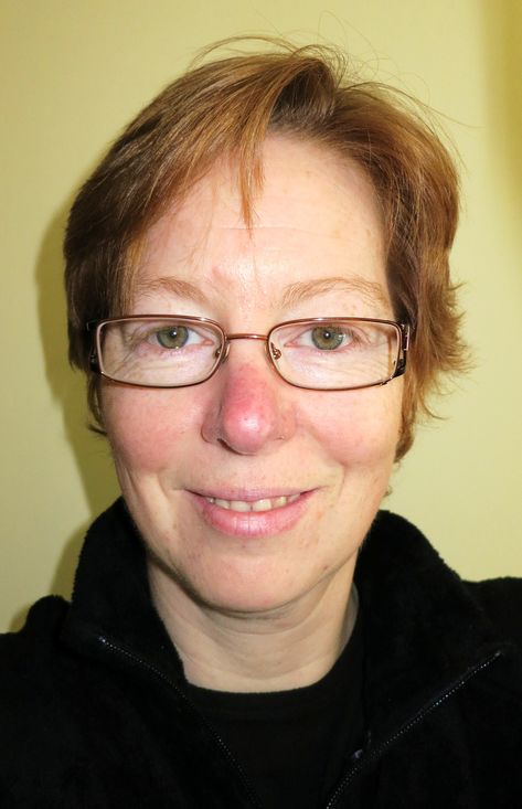 Do You Have Redness in Your Cheeks and Nose? You May Have Rosacea. Redness Around Nose, Acne On Nose, Red Rash, Red Cheeks, Acne Vulgaris, Beauty App, Skin Burns, Anti Redness, Skin Condition