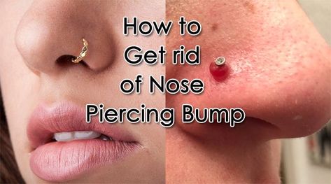 How to Get Rid of Nose Piercing Bump | Nose Piercing | Nose piercing bump, Nose piercing, Piercing bump Nose Ring Bump, Nose Piercing Scar, Nose Piercing Care, Nose Piercing Bump, Piercing Bump, Blind Pimple, Cute Nose Piercings, Scar Removal Cream, Nose Piercings