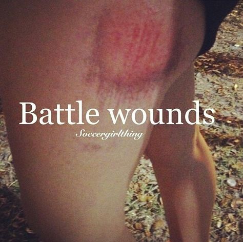 Turf burn Soccer Goalie Aesthetic, Uswnt Funny, Goalkeeper Quotes, Soccer Humor, Soccer Girl Probs, Turf Burn, Softball Memes, Soccer Problems, Soccer Pics