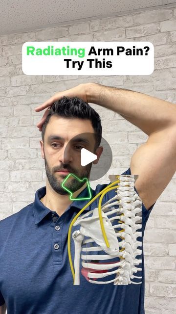 Dr. Joe Damiani - TMJ, Head & Neck Specialist on Instagram: "Do you have stiffness and pain in your shoulder along with a stiff neck and maybe some radiating pain into your arm or shoulder blade? While many people assume this is a shoulder problem, they can actually all be coming from the neck and overtime have degraded the function of the shoulder itself. Some of the classic signs of this are the radiating pain along with inability to turn neck. There are some excellent strategies to start the rehab process by realigning the neck to take pressure off the nerves. This can restore the dysfunctional signal down the nerve from the neck which causes the Shoulder to Stiffen up and feel like it’s a Shoulder problem. Give me this watch, try it out, and DM us with questions. #shoulderpain #shoulde Pinched Nerve In Shoulder Blade, Pinched Nerve In Shoulder, Trapped Nerve, Forward Head Posture Exercises, Shoulder Dislocation, Shoulder Problem, Neck And Shoulder Muscles, Neck Problems, Forward Head Posture