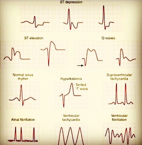 Cardiovascular Technician, Cath Lab Nursing, Nursing School Studying Cheat Sheets, Medical Terminology Study, Medical Assistant Student, Nurse Practitioner School, Nursing School Essential, Medical School Life, Nursing School Motivation