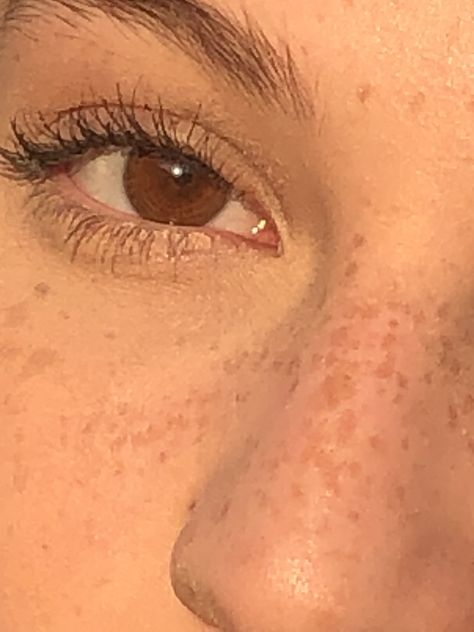 Brown Eyes And Freckles Aesthetic, Light Freckles On Nose Aesthetic, Freckled Skin Aesthetic, Brown Hair Brown Eyes Freckles Girl, Freckles Aesthetic Faceless, Birthmarks For Shifting, Brown Eyes With Freckles, Cute Freckles Aesthetic, Slight Freckles