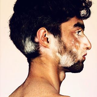 Moles Aesthetic, Diverse People, Portrait Series, Face Drawing Reference, Human Reference, Unique Faces, Face Reference, Face Photography, Beauty Portrait