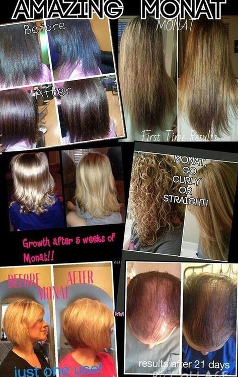 I can show you hundreds of before and afters, but I'd love yo show you yours! Grow your hair, reverse damage. Homemade Serum, Monet Hair Products, Monat Before And After, Monat Business, Diy Hair Masks, Brown Spots On Face, Hair Masks, Home Remedies For Hair, Monat Hair