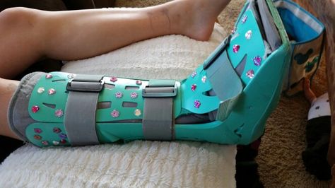 Cadie's blinged out walking boot / air cast.  Spray painted and sparkle stickers. Crutch Decorations, Air Cast Boot, Walking Cast Boot, Ankle Recovery, Cam Boot, Walking Cast, Cast Decoration, Medical Boot, Air Cast