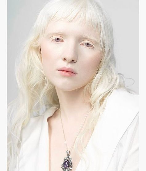 Nastya Zhidkova, Albino Model, Albino Girl, White Hair, Madonna, Hair Inspo, Character Inspiration, Beautiful People, Blonde Hair