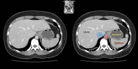 Ct Abdomen Anatomy, Ct Anatomy, Learning Anatomy, Interventional Radiology, Junior Doctor, Physics Notes, Xray Tech, Branding Resources, Ct Scan