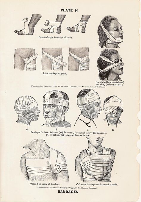 Bandage Art Reference, Loose Bandages Drawing Reference, Neck Bandage Reference, Bandage Medical Aesthetic, Vintage Reference Photos, Old Medical Aesthetic, Injury Art Reference, Medical Journal Aesthetic, Stitches Drawing Medical