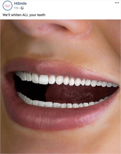 Trending On Pinterest, Trend Quote, Creepy Images, Design Fails, Weird Images, Natural Teeth Whitening, Color Corrector, Bad Design, Dental Practice