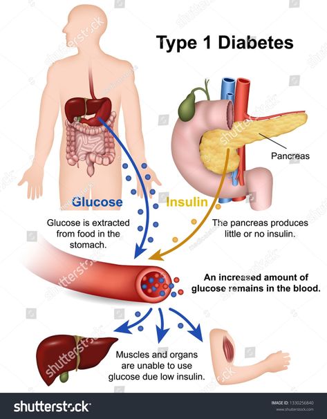 Sistem Pencernaan, Medical Training, Vie Motivation, Medical Terms, Salford, Lower Blood Sugar, Eating Well, Fun To Be One, Type 1