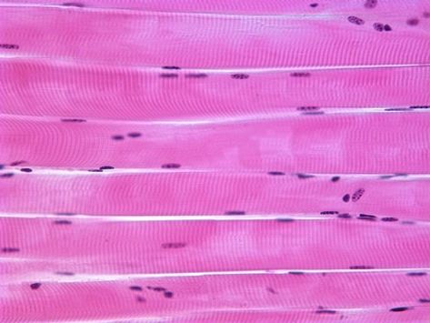 Muscles , 4 Skeletal Muscle Tissue Slide : Skeletal Muscle Histology Skeletal Muscle Tissue, Serous Membrane, Loose Connective Tissue, Hyaline Cartilage, Smooth Muscle Tissue, Histology Slides, Types Of Muscles, Cell Forms, Bahasa China