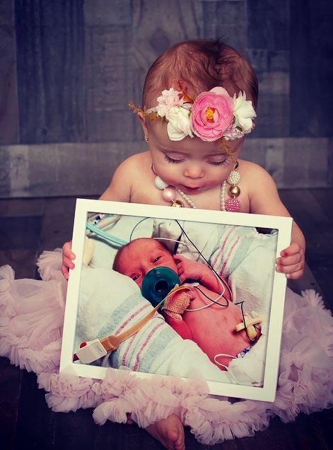 #preemie #miraclebaby #thenandnow #nicu #nicugrad #firstbirthday #firstbirthdaypictures #preemiephotoidea One Month Nicu Photos, Nicu Baby Pictures Photo Ideas, Preemie First Birthday Ideas, Preemie Photoshoot, Preemie Mom Quotes, Baby Birthday Pictures, Preemie Mom, Mother Baby Photography, Isabella Rose