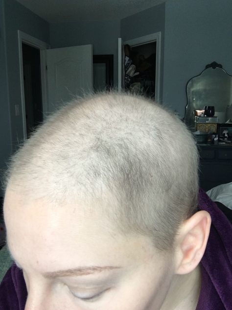 Growing Hair After Chemo, Hair Growth Post Chemo, Tips For Hair Growth, Hair Growth After Chemo, Tips For Hair, Chemo Care, Chemo Hair, Boost Hair Growth, Regrow Hair