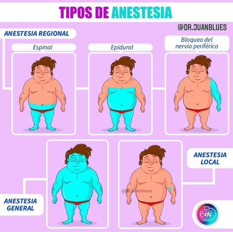 Anestesia regional, local y general #medstudent Medicine Studies, Medical School Essentials, Med Student, Nursing Notes, School Essentials, Medical School, San Pedro, Anatomy, Nursing