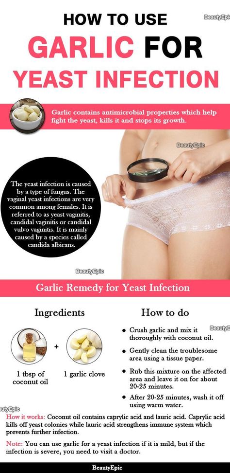 You aren't just restricted to an antifungal cream when it pertains to treating yeast infections. You might currently have a few of these natural remedy for genital yeast that you might not be aware of. #yeastinfectionsymptoms Garlic For Yeast Infection, Garlic Remedies, Chronic Yeast Infection, Treat Yeast Infection, Yeast Infection Symptoms, Types Of Fungi, Yeast Infections, Candida Albicans, Healthy Diet Tips