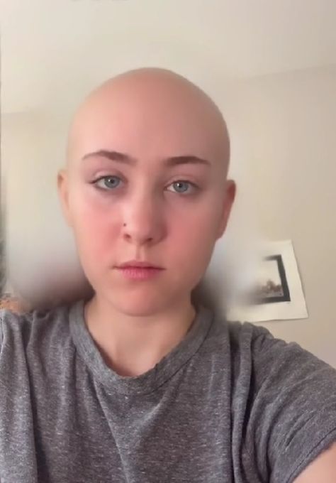 bald chappell roan. (via chappell's tiktok)

october 21st, 2021 Chappell Roan Straight Hair, Chappell Roan Funny, Chappell Roan Pfp, Chapple Roan, Chapell Roan, Chappel Roan, Pink Pony Club, Olivia + Core + Aesthetic, Pig Nose