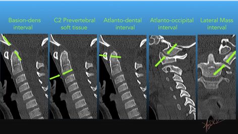 Pediatric Radiology, Normal Values, University Of Washington, Med School, Radiology, Pediatrics, Washington, University, Medical