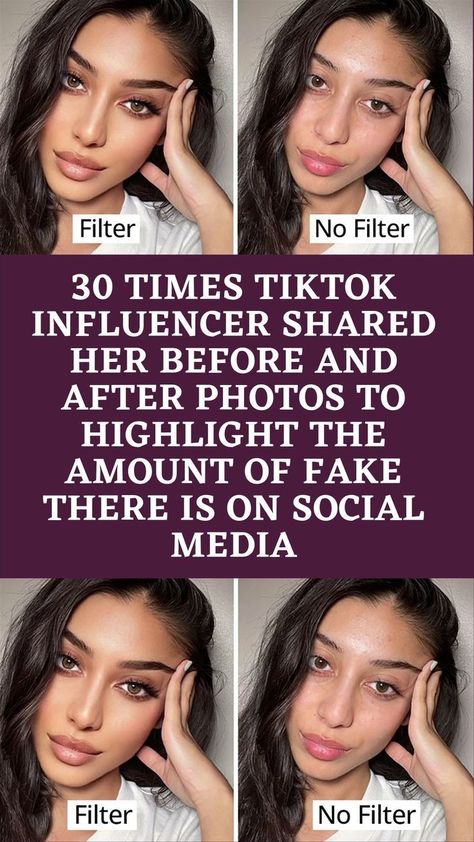 30 Times TikTok Influencer Shared Her Before And After Photos To Highlight The Amount Of Fake There Is On Social Media Celebrity Surgery, Cute Uggs, Tiktok Influencer, Celebrity Facts, Funny Story, Makeup Transformation, Photo Background Images, Hollywood Fashion, After Photos