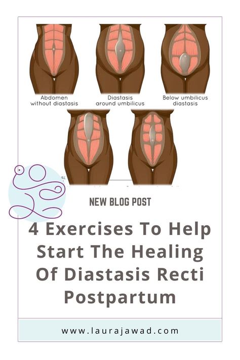 Abdominal Separation Diastasis Recti, Wall Pilates For Diastasis Recti, Diastasis Recti Wall Exercises, 8 Weeks Postpartum, Abdominal Exercises After C Section, Diastasis Recti Exercises In Bed, Fix Diastasis Recti 21 Days, Heal Diastasis Recti Fast, Transabdominal Exercises