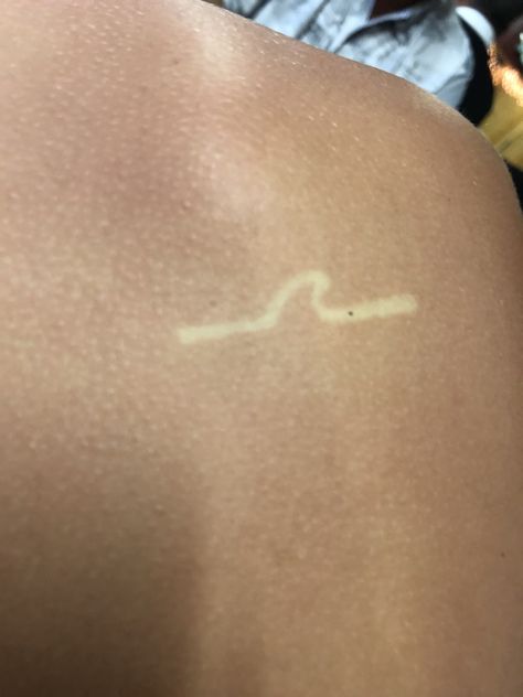 Suntan tattoo Sunburn Tattoo Ideas, Tanning Tatoos, Sunscreen Tattoo Ideas, Sun Tan Tattoo Ideas, Sunburn Tattoo, Selfcare Weekend, Suntan Tattoo, Steampunk Boots Women, Sunscreen Tattoo