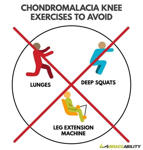 Chondromalacia knee exercises to avoid including lunges, deep squats, and leg extension machine Knee Training, Pots Management, Patellofemoral Pain Syndrome Exercises, Hidden Illness, Lady Tips, Knee Pain Relief Exercises, Exercise Therapy, Patellofemoral Pain Syndrome, Knee Pain Remedy